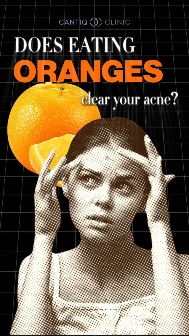 🍊 Heard oranges can clear acne?
Yes, Vitamin C is good for skin — but eating fruit alone won’t cure pimples.

Acne is caused by hormones, clogged pores & oil.
👉 You need the right routine + pro care for real results.

📩 DM us to start your clear skin journey today!

📍 CANTIQ Clinic Klang http://wasap.my/60123099366
📍 CANTIQ Clinic Cheras http://wasap.my/601169411227
📍 CANTIQ Clinic Setapak http://wasap.my/60125689366
📍 CANTIQ Clinic Melaka http://wasap.my/60128619366

📞 WhatsApp us now to book your slot! Limited slots available!

#AcneCare #ClearSkin #CantiqClinic #AcneTreatment #AcneSolution #SkinCareTips #HealthySkin #SkincareMY #DermatologyCare #GlowingSkin #NoMoreAcne #SkinConfidence #FacialMalaysia #AcneFreeJourney