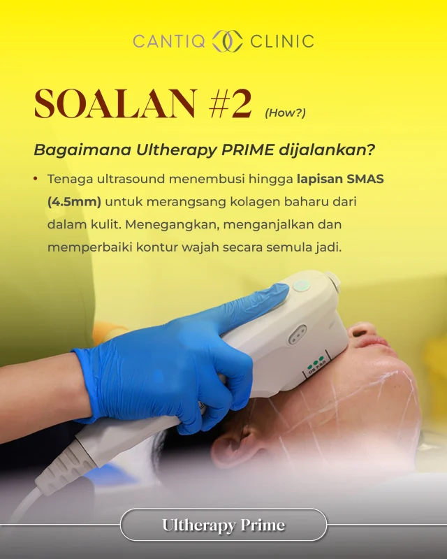 💛 “Bagaimana Ultherapy PRIME dijalankan?”（How?）

Macam mana Ultherapy PRIME berfungsi? 🔍
Tenaga ultrasound fokus mikro menembusi kulit hingga ke lapisan SMAS (4.5mm) — lapisan yang sama dirawat dalam pembedahan facelift!
Hasilnya? 🌸

➡️ Kolagen baru dirangsang dari dalam
➡️ Kulit jadi lebih tegang & anjal
➡️ Wajah nampak lebih runcing & natural

Tanpa luka, tanpa jarum — hanya teknologi pintar yang bantu wajah kekal muda. 💫
📅 Tempah sesi konsultasi anda hari ini!

📍 CANTIQ Clinic Klang http://wasap.my/60123099366
📍 CANTIQ Clinic Cheras http://wasap.my/601169411227
📍 CANTIQ Clinic Setapak http://wasap.my/60125689366
📍 CANTIQ Clinic Melaka http://wasap.my/60128619366

📞 WhatsApp kami sekarang untuk tempah slot anda! Tempat terhad!

#UltherapyPrime #CantiqClinic #FaceliftTanpaPembedahan #RawatanKulit