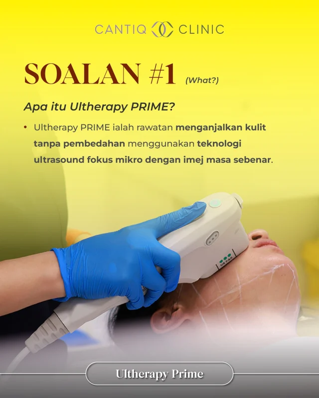 💛 “Apa itu Ultherapy PRIME?”（What?）

Nak kulit lebih tegang tanpa pembedahan💆‍♀
💡 Ultherapy PRIME ialah rawatan bukan pembedahan yang menggunakan teknologi ultrasound fokus mikro untuk menganjalkan kulit secara semula jadi — siap dengan imej masa sebenar untuk hasil yang tepat dan selamat!

✨ Kelebihan utama:
✅ Tiada downtime
✅ Tidak menyakitkan
✅ Dijalankan oleh doktor bertauliah

✨ Cuba Ultherapy PRIME di CANTIQ Clinic dan rasai perbezaannya dari dalam!

📍 CANTIQ Clinic Klang http://wasap.my/60123099366
📍 CANTIQ Clinic Cheras http://wasap.my/601169411227
📍 CANTIQ Clinic Setapak http://wasap.my/60125689366
📍 CANTIQ Clinic Melaka http://wasap.my/60128619366

📞 WhatsApp kami sekarang untuk tempah slot anda! Tempat terhad!

#UltherapyPrime #CantiqClinic #NonSurgicalLift #KulitAnjalSemulaJadi