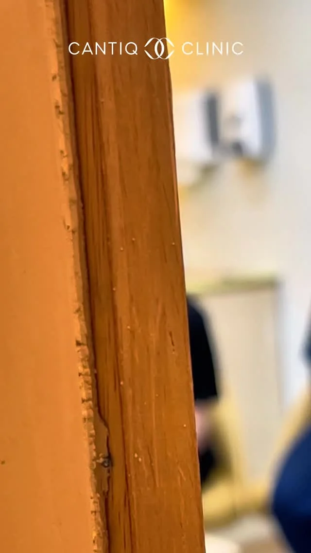 ✨ Kenapa Doktor Kami Dilatih Khas untuk Ultherapy Prime? ✨

Ultherapy Prime bukan sekadar rawatan biasa. Ia memerlukan ketepatan, kefahaman mendalam tentang struktur kulit dan teknik ultrasound yang betul.

Sebab itu di CANTIQ Clinic, setiap doktor menjalani latihan khusus sebelum melakukan rawatan ini. Dari drawing face hingga ke kawalan tenaga pada kedalaman yang tepat, semuanya dilakukan dengan teliti untuk memastikan hasil paling selamat, semula jadi dan berkesan 💎

Kerana bagi kami, kecantikan bukan tentang cepat tapi perlu tepat.

💛 Ultherapy Prime di tangan doktor terlatih untuk hasil yang anda boleh lihat dan rasa.

#UltherapyPrime #CantiqClinic #DoctorTrained #PrecisionLift #SafeAesthetic #NaturalResults